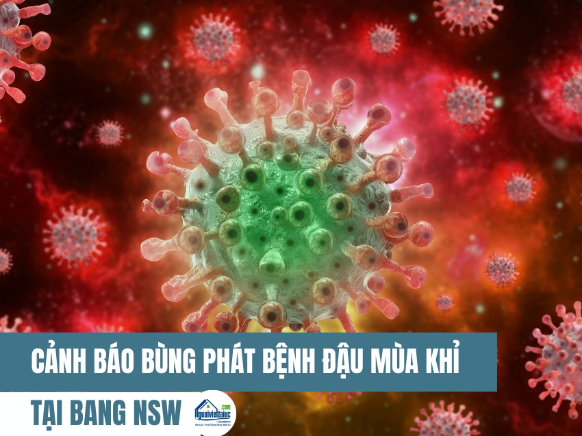 Cảnh báo bùng phát bệnh đậu mùa khỉ tại bang New South Wales